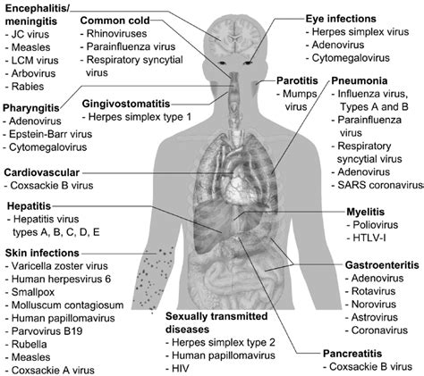 the type of viral infection figgerits|Overview of Viral Infections .